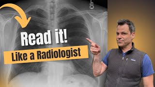 You’re Reading Chest X-Rays Wrong — Here’s How Radiologists Do It