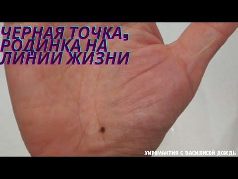 Точка, пятно, родинка на линии жизни. Линия сглаза, здоровье на фото рук. Хиромантия