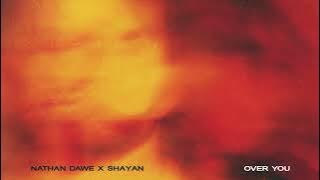 Nathan Dawe x Shayan - Over You