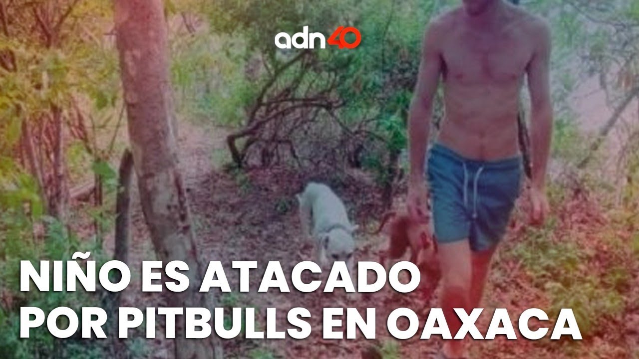 Un niño fue atacado por pitbulls y se debate entre la vida y la muerte ...