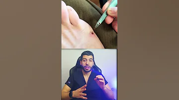 التهاب جلدي التهاب الالتهابات جلدية جلد تعقيم جرح جروح د مصعب حسوا ثقف نفسك طبيا 