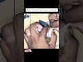 Cockatiel Leg Injury? Here's How We Treated It and Saved Him 🐣❤️ #ChashBirds