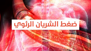 Pulmonary Artery Hypertension | ارتفاع ضغط الشريان الرئوي