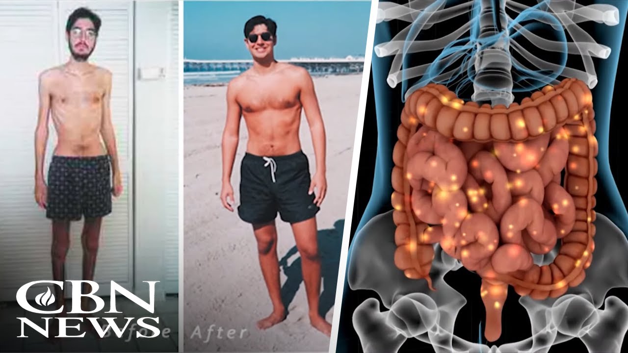 The importance of Probiotics