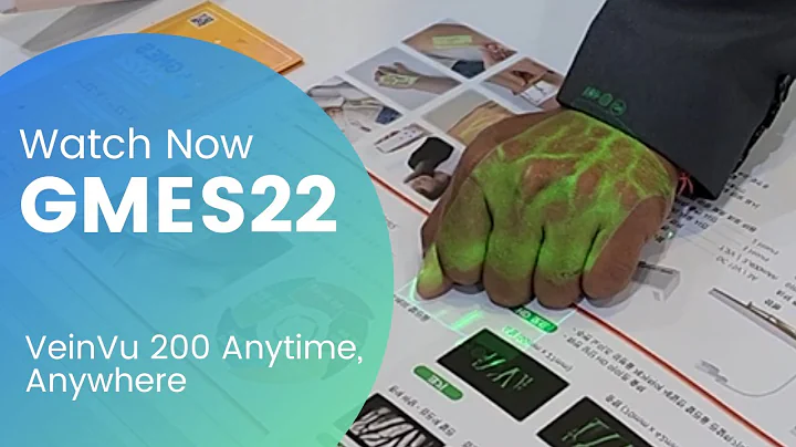 The best vein viewer VeinVu 200 | Easy Vein Finder | GMES22 | Highlights جهاز كشف الأوردة | سحب دم