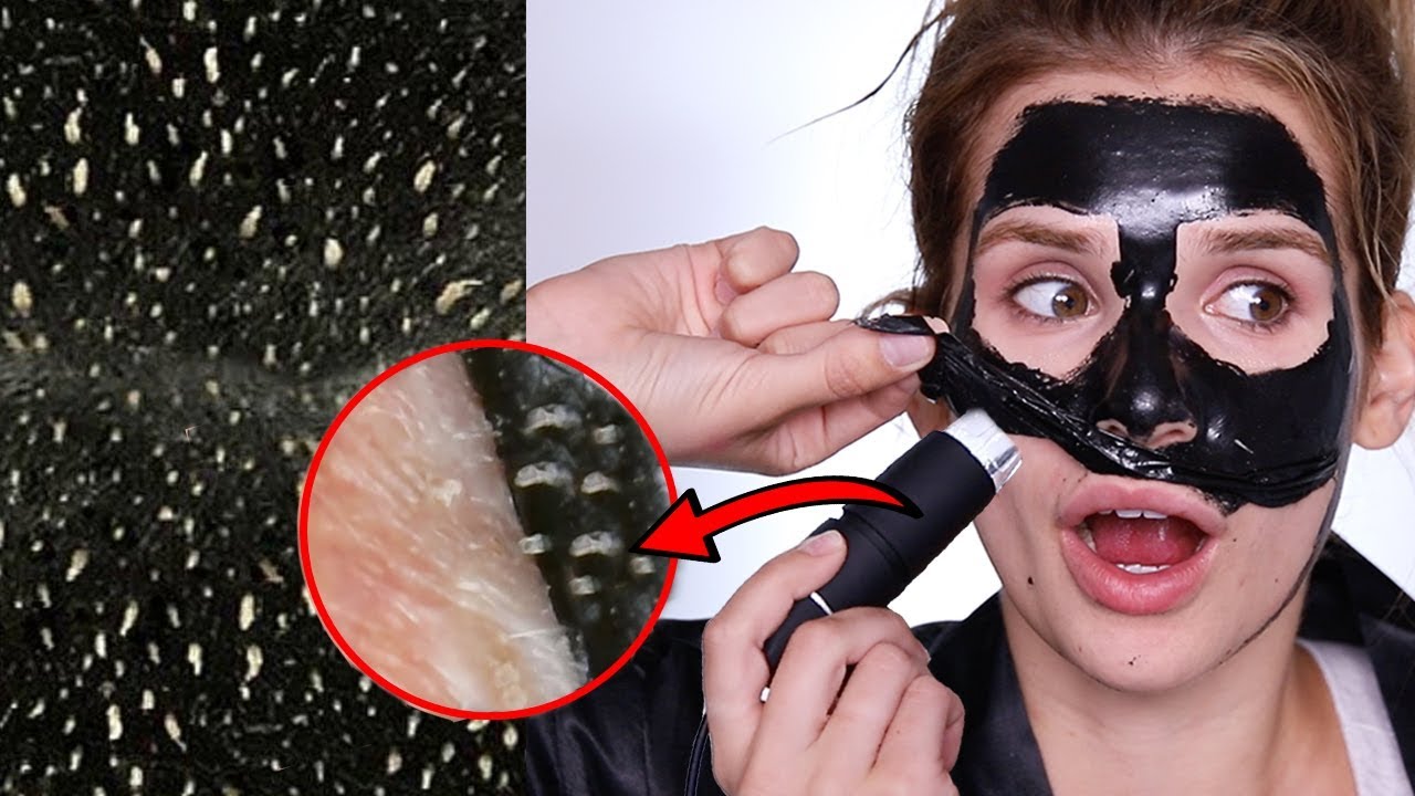 BLACKHEAD PEEL-OFF UNDER A MICROSCOPE! ew omg satisfying