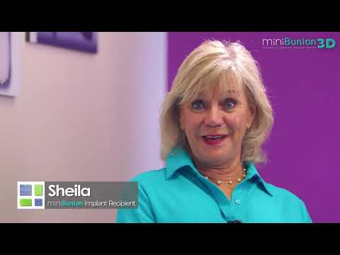 miniBunion® 3D Patient Testimonial - Sheila