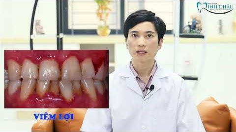 04 Vấn Đề Răng Miệng Thường Gặp | Kiến Thức Nha Khoa