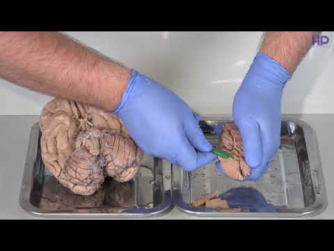 Нейробиология | Общее строение головного мозга. Часть 1