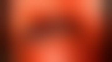 Dr. Mian - right microvascular decompression for trigeminal neuralgia