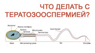 Что делать с Тератозооспермией? / Доктор Черепанов