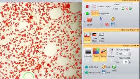 Smart Segmentation Video Tutorial   Image Pro Premier Software