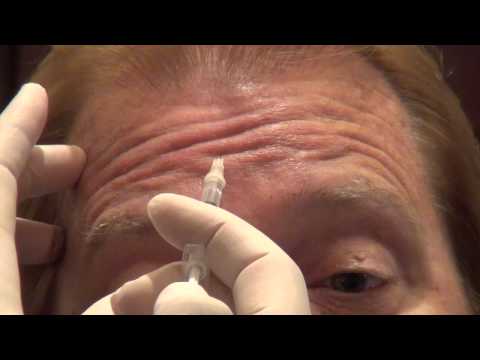 Botox Training - Forehead Injections - Empire Medical