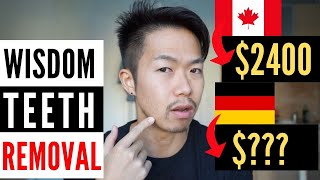 [Ep.1 of 3] Wisdom Teeth Removal in Germany: Cost. Insurance. Process. English.