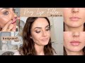 Looking back at my lip filler injections  my new lip plumping routine