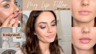 looking back at my lip filler injections my new lip plumping routine