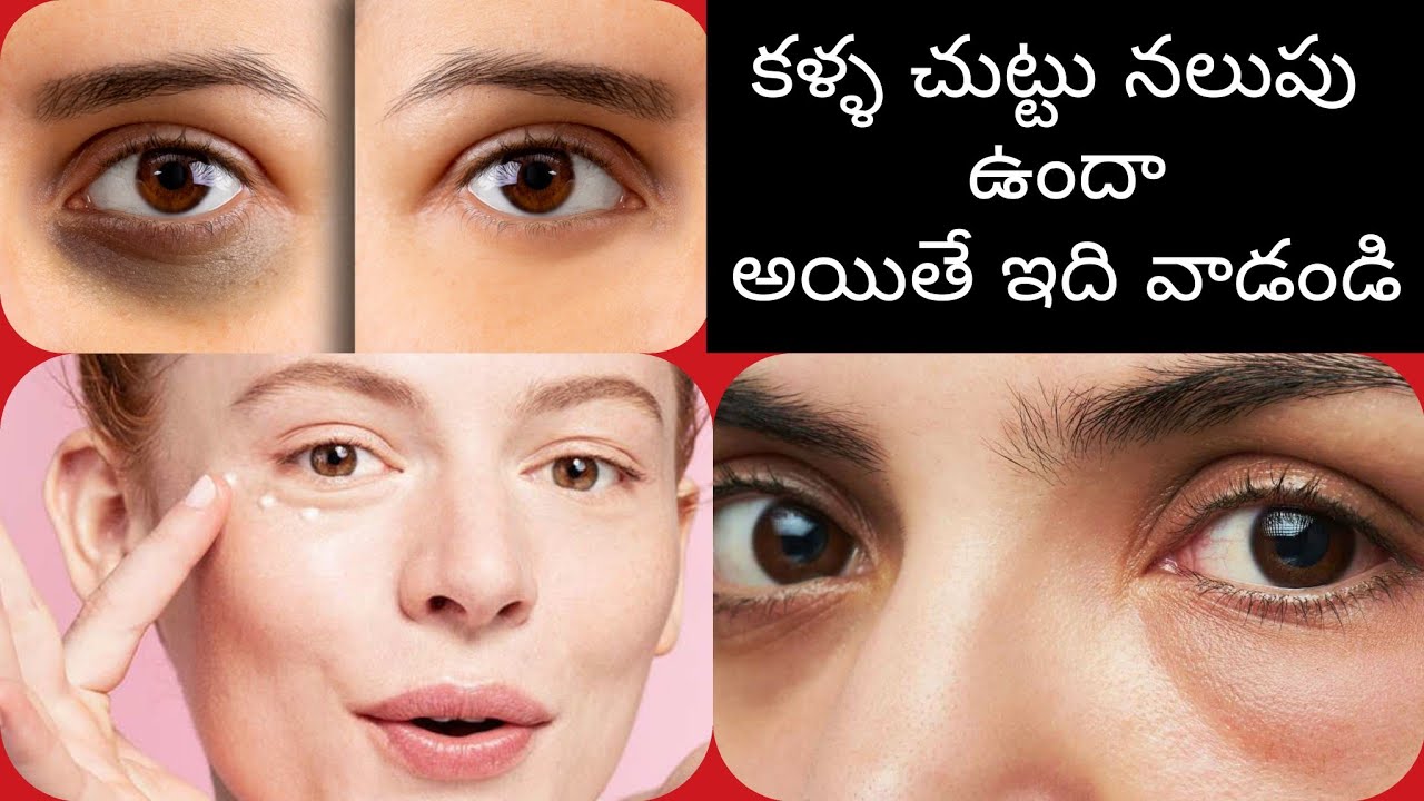 Remove under eye dark circles permanently in Dark Circles Under Eyes