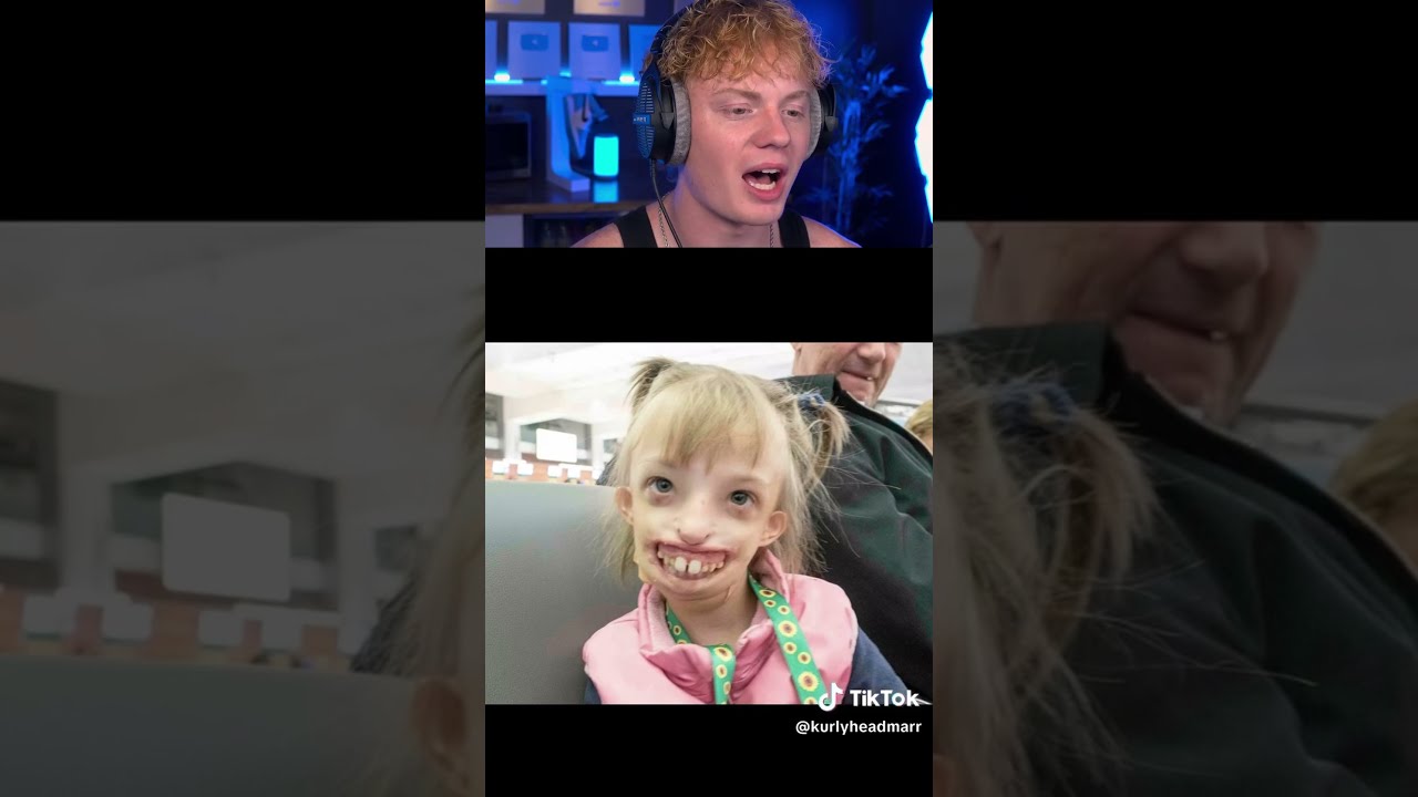 People Born Without Body Parts 