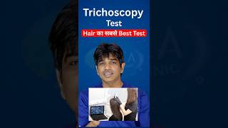 Hair Fall ka Real Reason | Trichoscopy Test | Scalp Analysis Test Explained