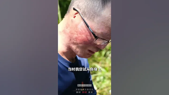 致敬英雄！重度燒傷消防員看望犧牲戰友，每個畫面都令人淚目 - 天天要聞