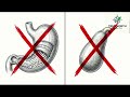 The #1 Vitamin Deficiency Causing Dry Eyes, Dry Mouth &amp; Bumpy Skin