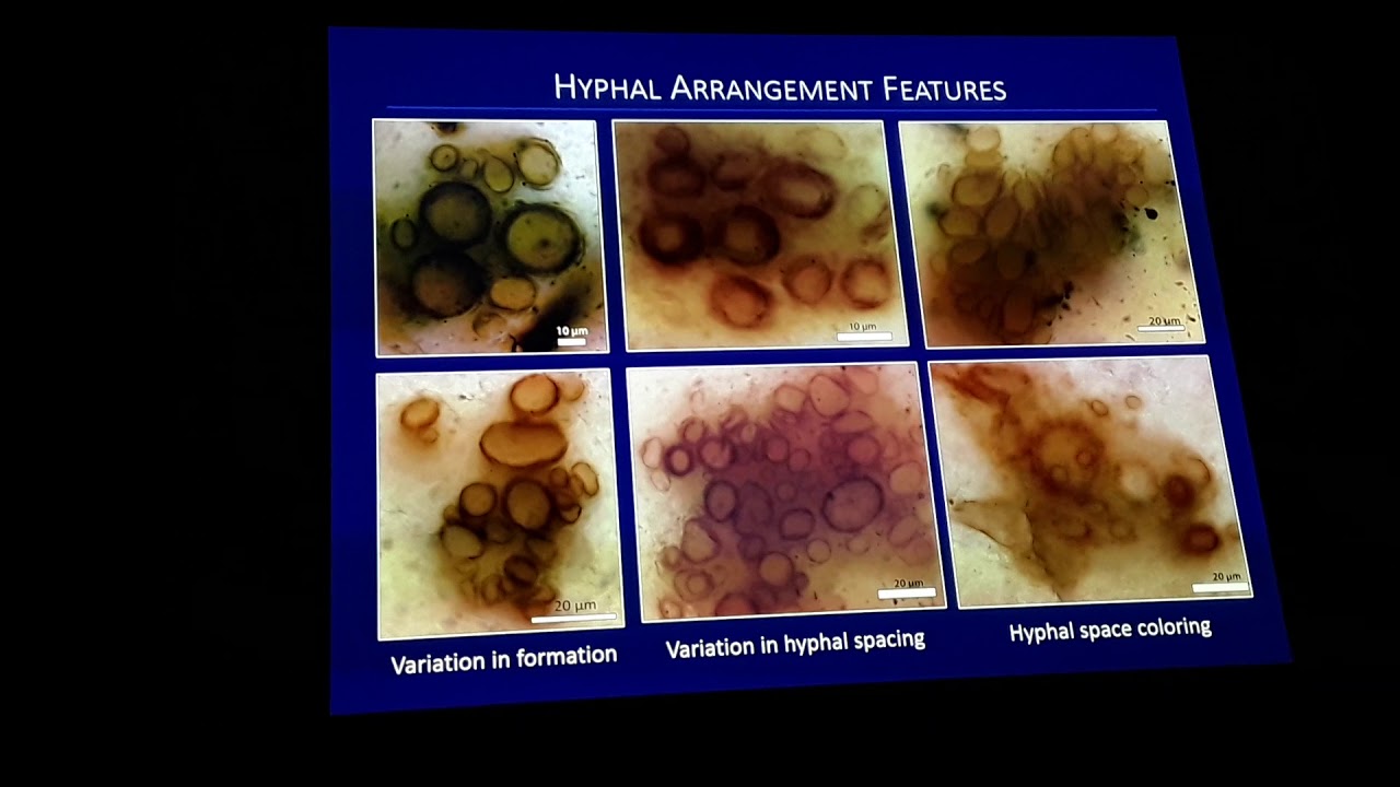 Madison Foster: Unraveling the diversity of mycelial cords from the Lower Devonian Rhynie chert