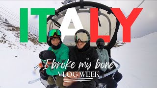 สกี ลับที่ Italy เล่นจนไหล่หักแบบของแทร่ | KARNFOEI EP.82