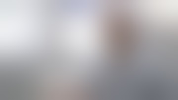 Proximie meets robotic surgery