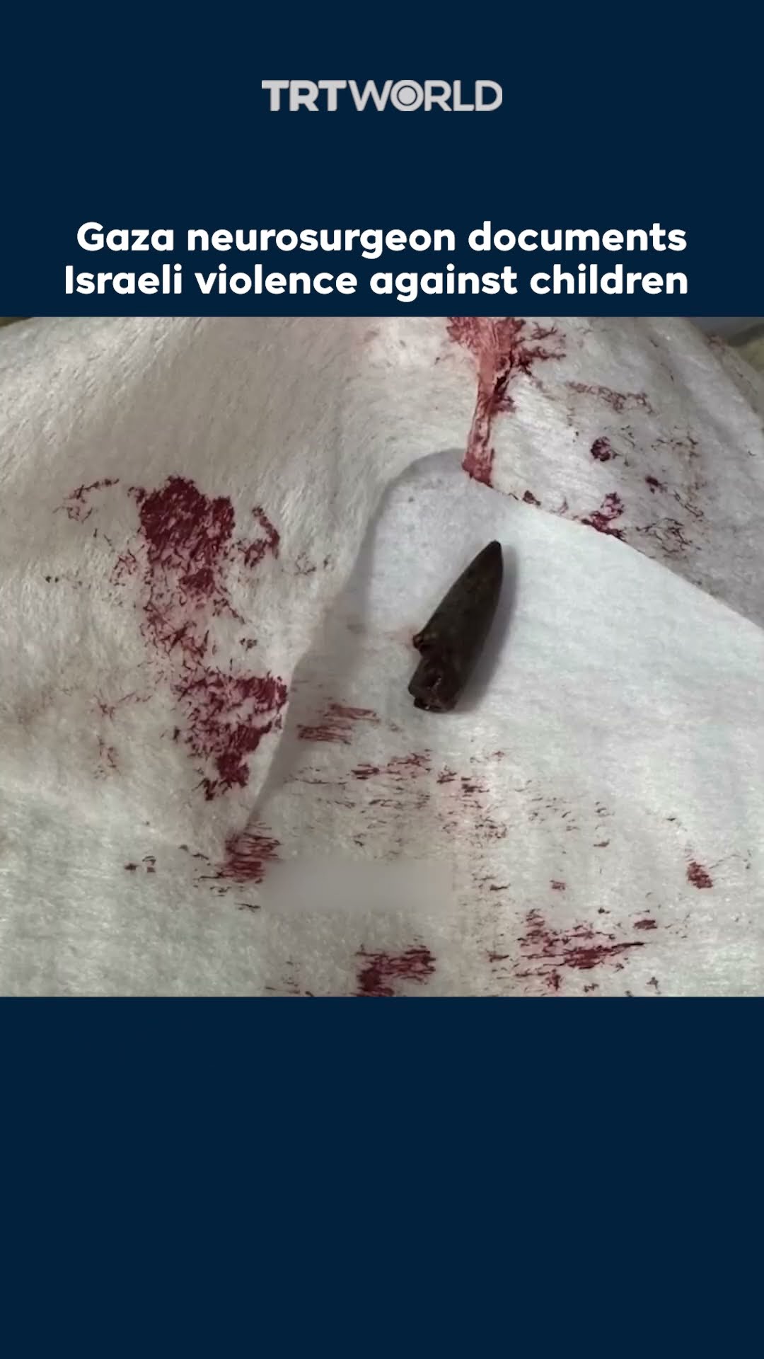 Gaza neurosurgeon shares evidence of Israeli attacks on Palestinian children