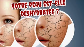 DIY beauté : Un masque hydratant pour le visage||? les bienfaits du miel sur la peau