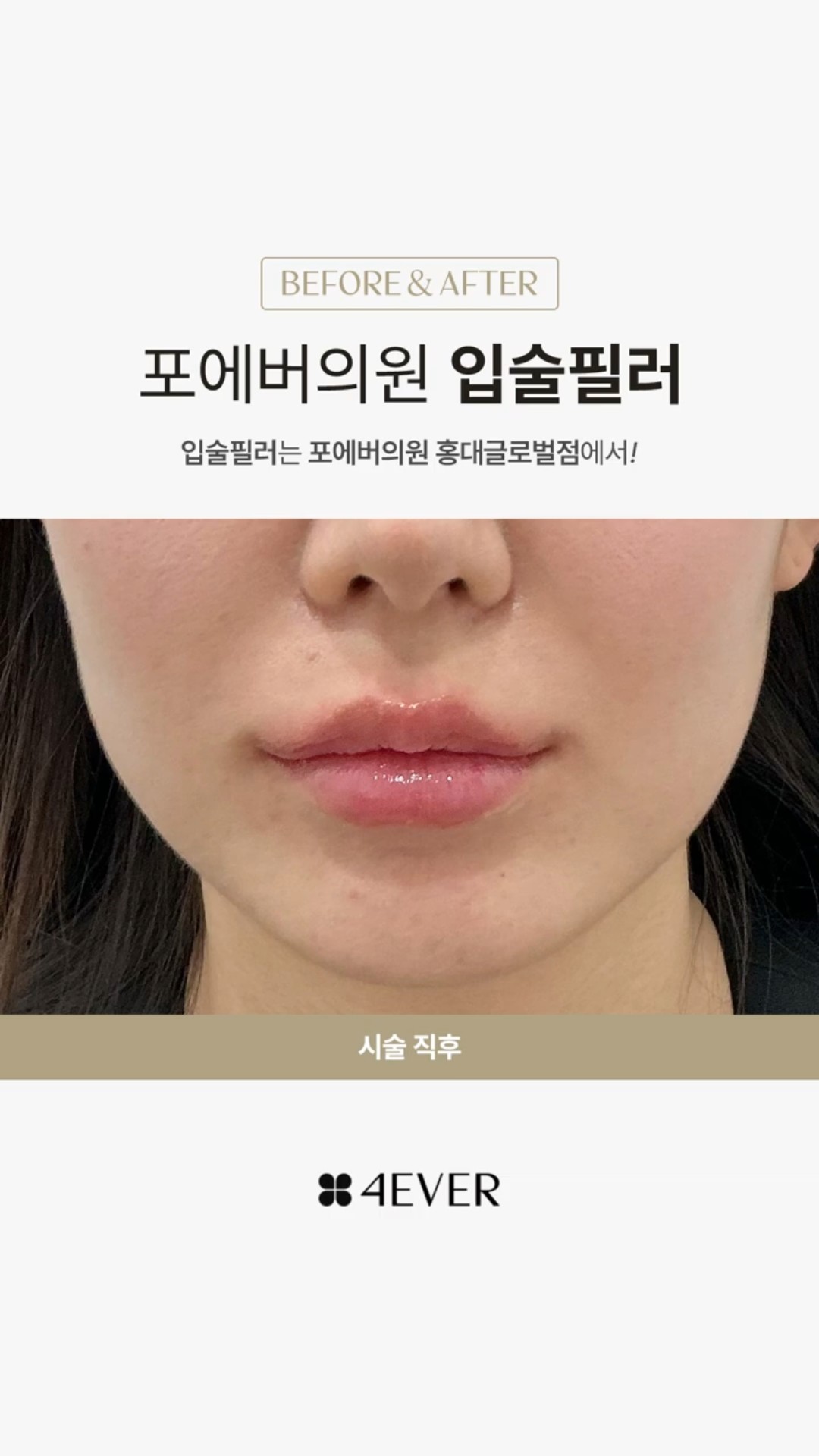 쇼츠