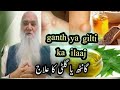 Gilti ya ganth ka ilaaj sheikh iqbal salfi mualij jin jadoo nazar ilaaj