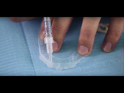 فيديو: كيفية استخدام شرائح تبييض الأسنان: 15 خطوة (بالصور)