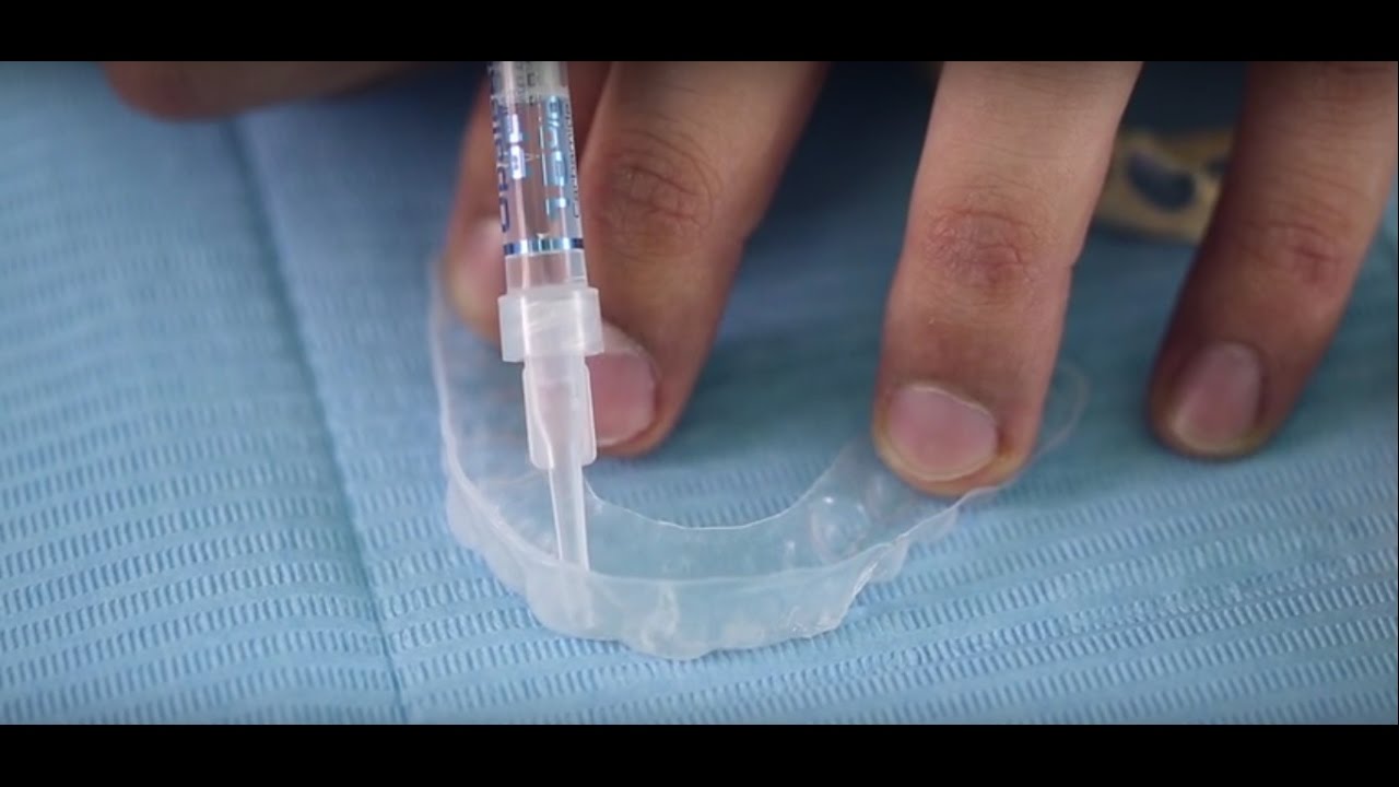 طرق تبييض الاسنان - د. سلمان سالم صرخوه