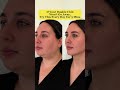 6 exercise to remove double chin #doublechin #faceyoga