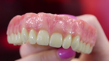 EnvisionTEC Vida | Digital Dentures with Dr. Cooper