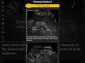 Pancreas Series 2: Acute Pancreatitis