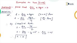 Famous Indeterminate Forms Part 2 Net Worth