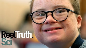 A World Without Downs Syndrome: Scientific Discovery | Science Documentary | Reel Truth. Science