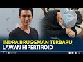 Kabar Terbaru Aktor Indra Bruggman, Lawan Hipertiroid Hingga Berat Badan Susut 10 Kg