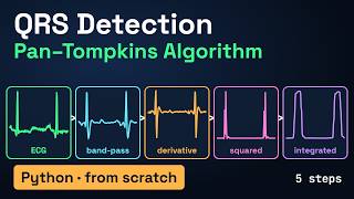 Pan-Tompkins QRS Detection from Scratch in Python | Real-Time ECG MIT-BIH (44 Records)