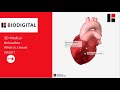 3d medical animation  what is a heart attack