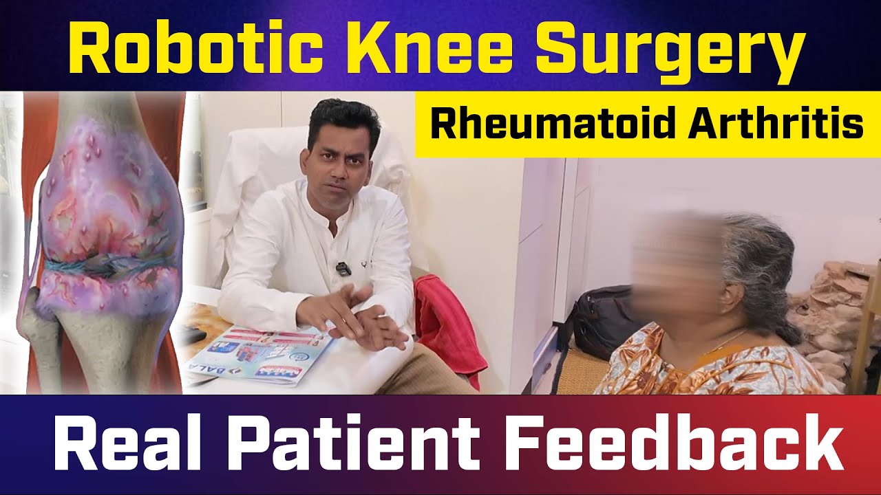 💥Robotic Knee Surgery for RA Explained! | Real Patient Feedback ...