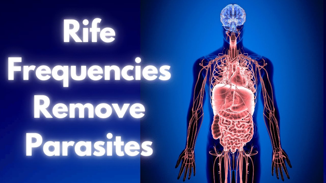 Parasites General Worms RIFE Frequencies Remove Parasites Parasites General Worms RIFE Frequencies Remove Parasites