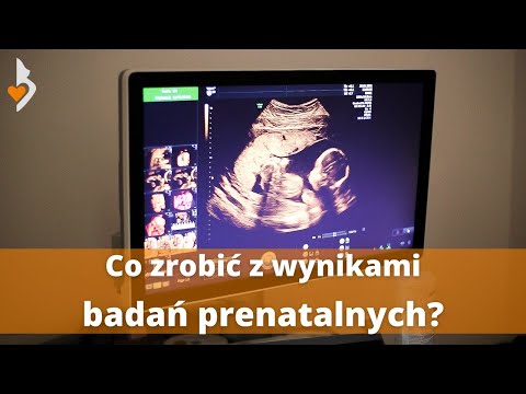 Wideo: 3 sposoby na podjęcie decyzji o wykonaniu badania prenatalnego
