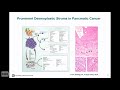 TRACO 2018 - Pancreatic cancer and Nanotechnology