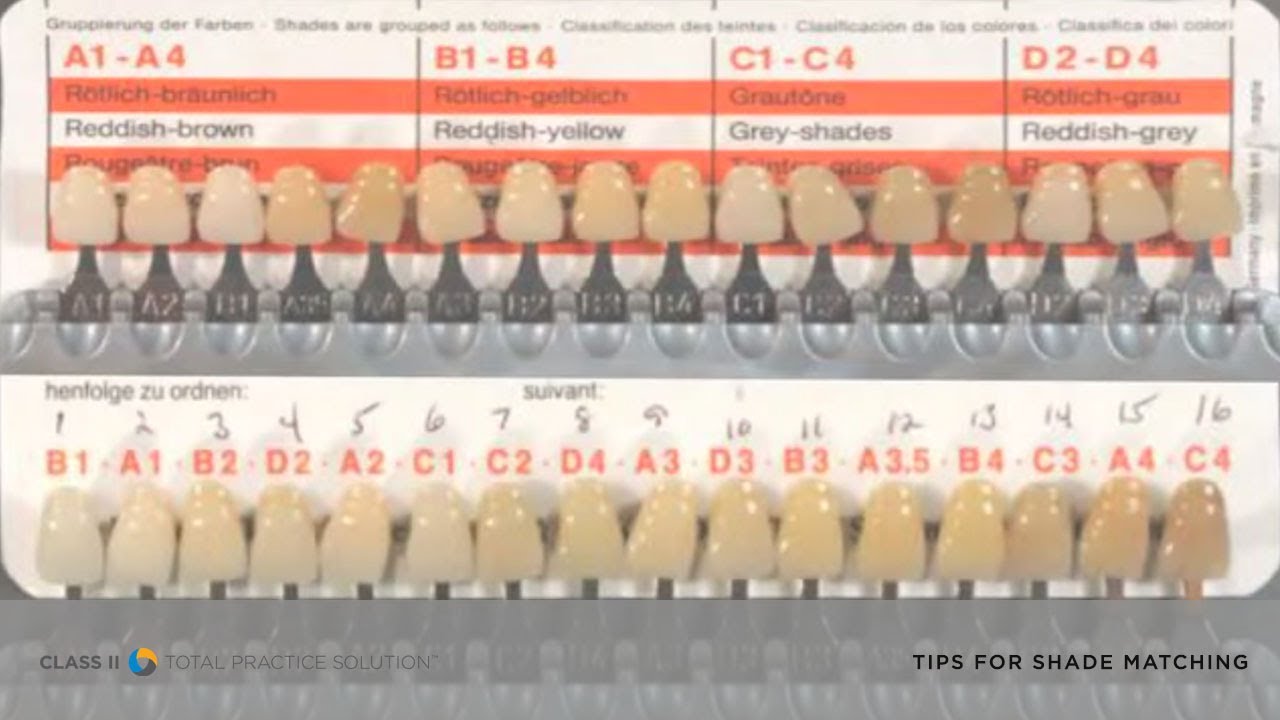three-tips-for-shade-matching-in-a-class-ii-dental-restoration-dentsply-sirona-youtube