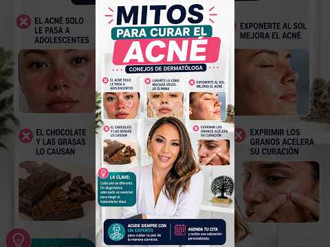 Mitos para Curar el Acné - Conejos de dermatóloga