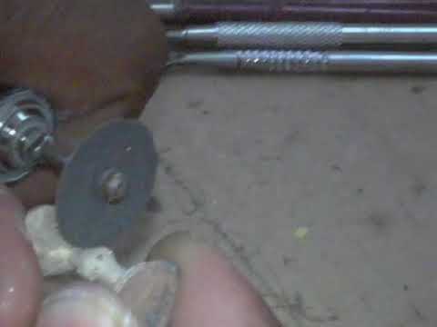 21. Removal of Sprue