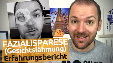 Kann eine Gesichtslähmung bleiben?